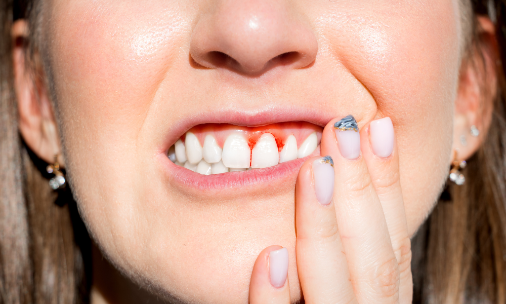 Show Your Gums Some Love