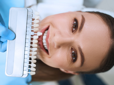 10 Things to Know About Veneers