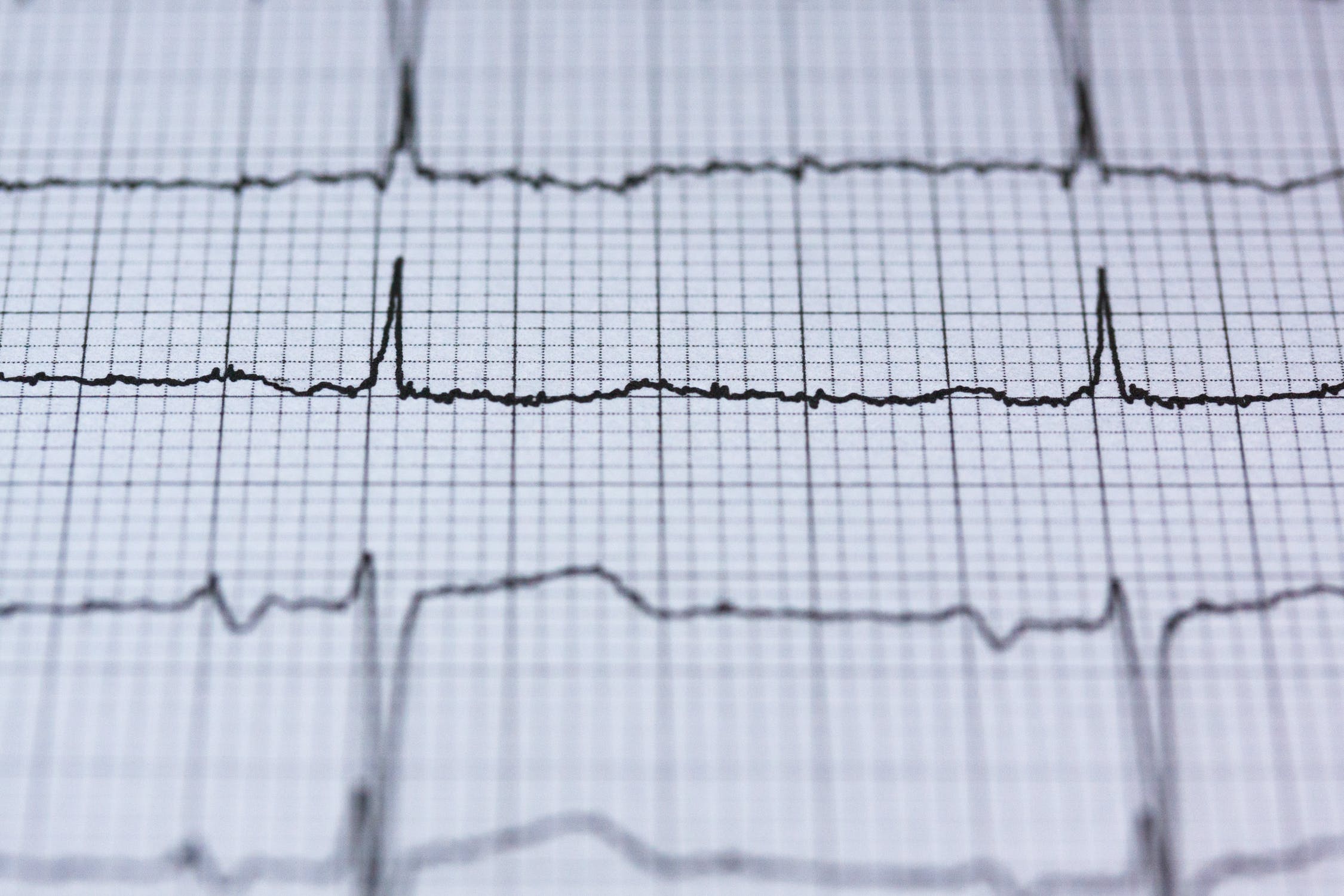 Heartbeat.jpeg