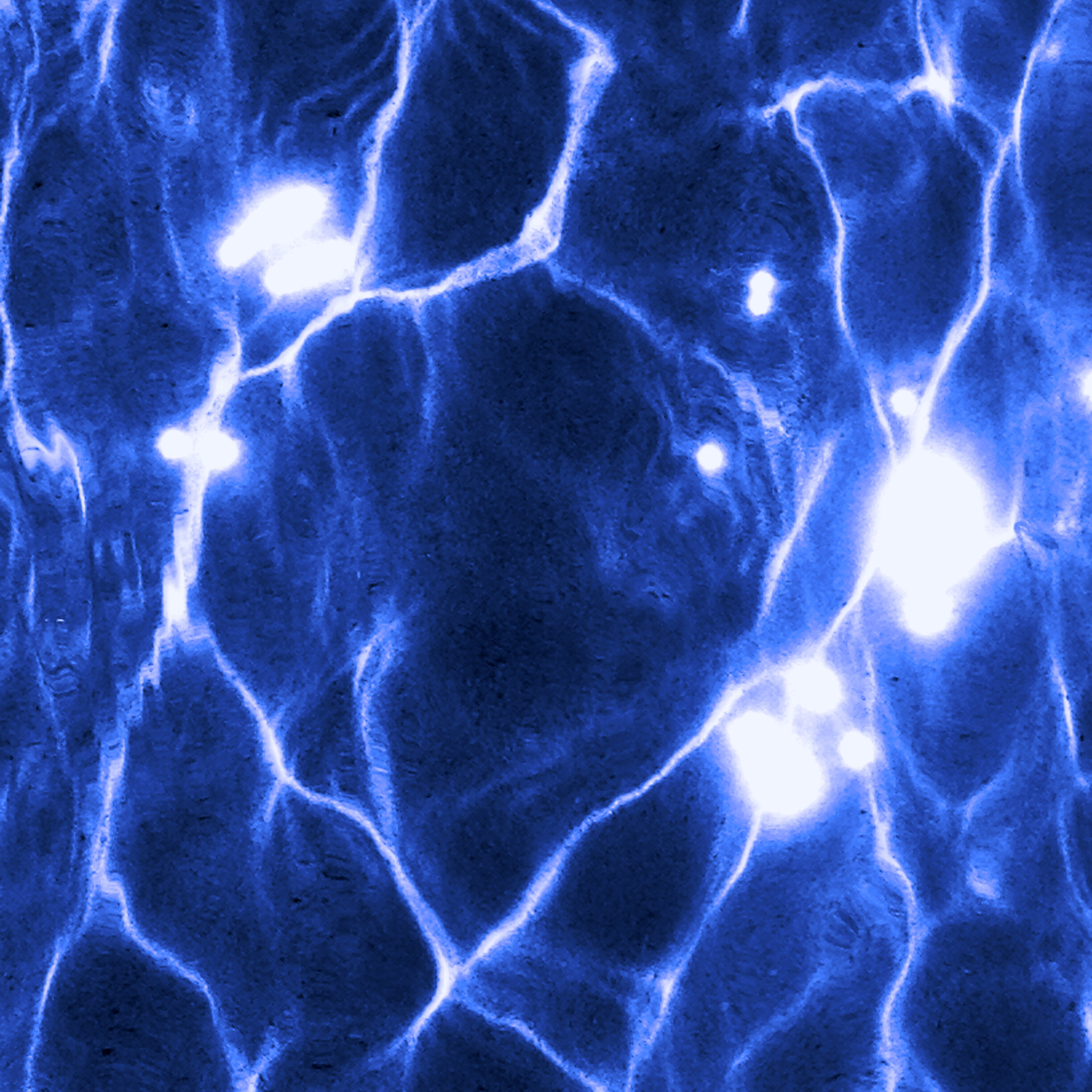 Blue Square