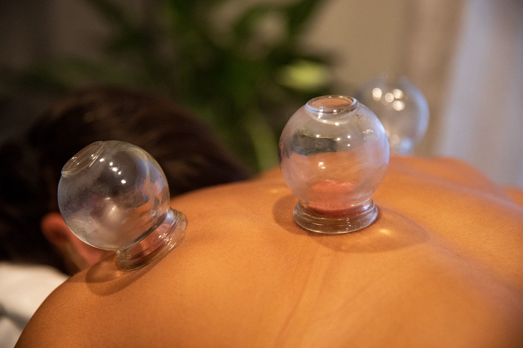 cupping pic.jpg