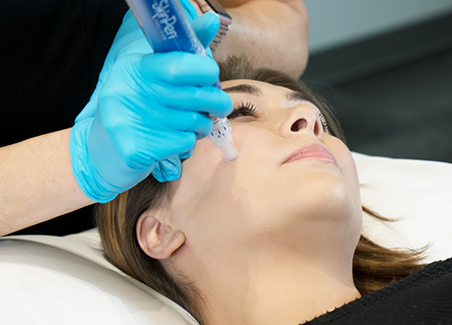 skinpen-microneedling-fda-approved-treatment.png