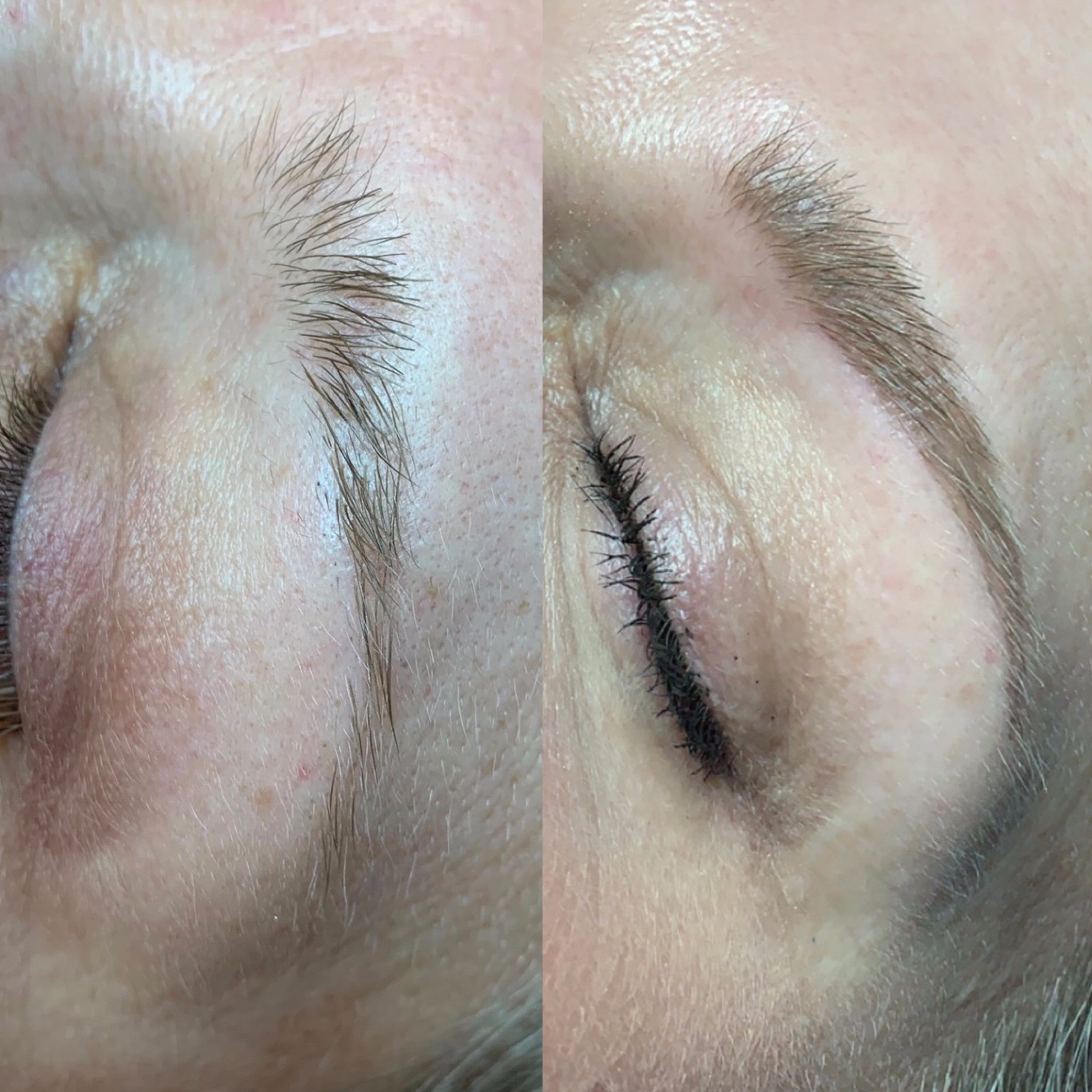 Microblading