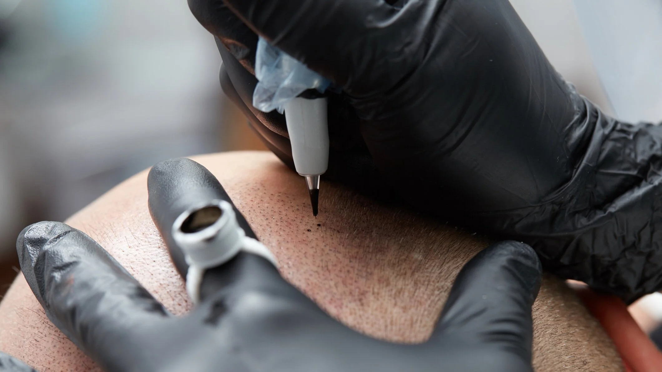 SMP - Scalp Microblading, Nano Hairline, & Beard Micropigmentation information and pricing