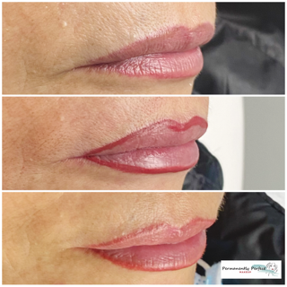 Permanent lip liner before and after for naturally defined, lined lips.
