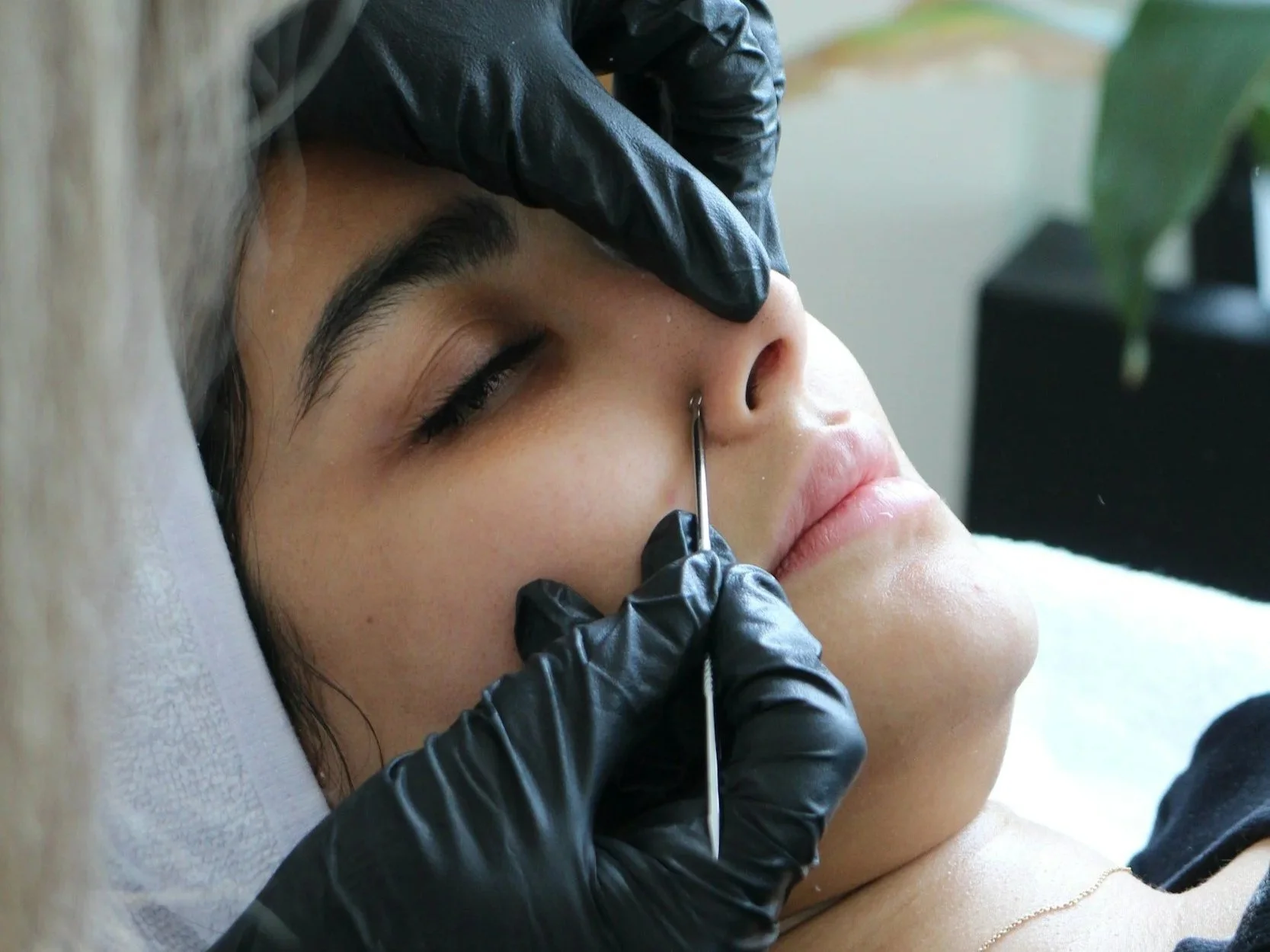 Facial Extractions Shadyside Pittsburgh