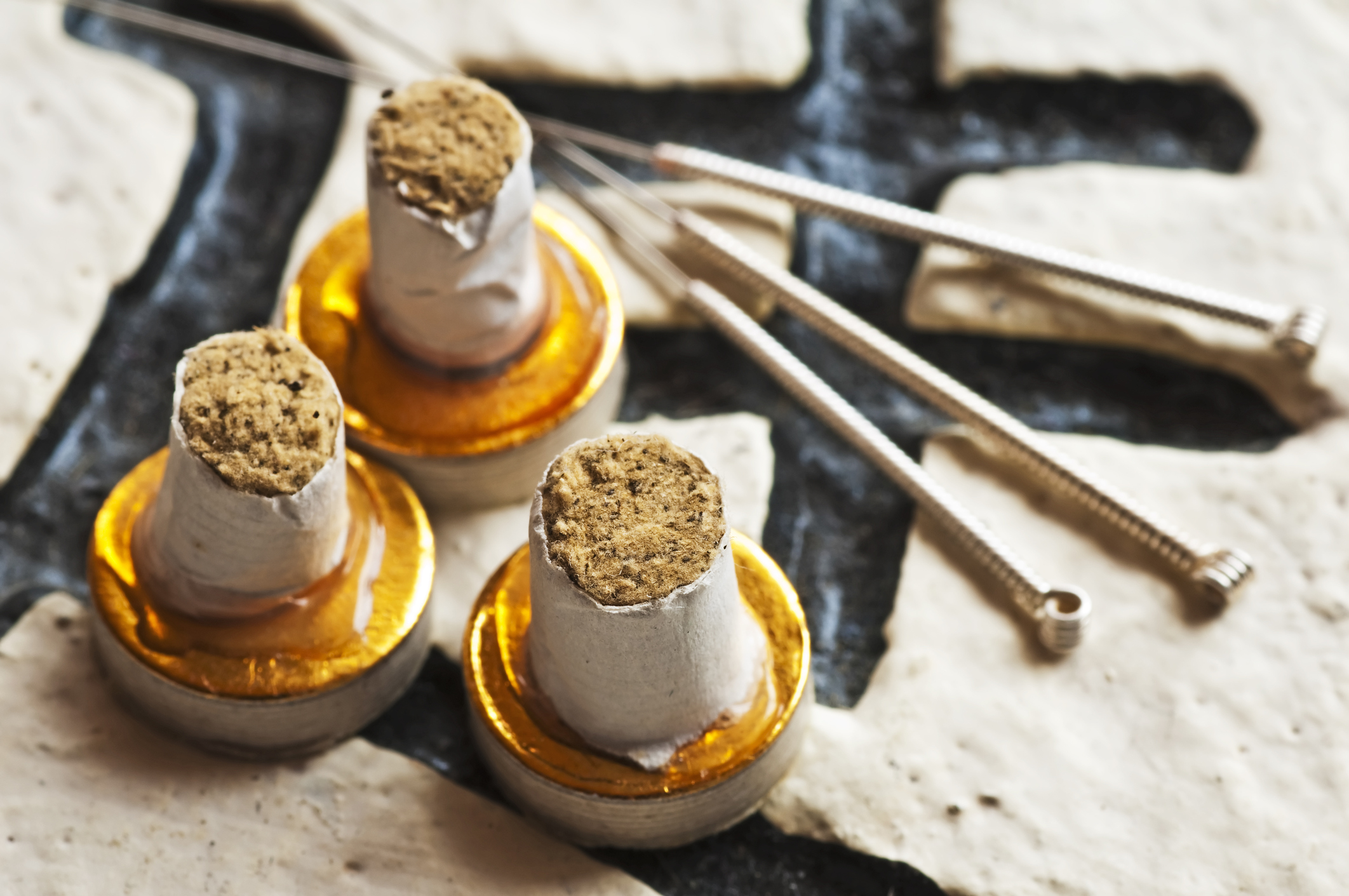 Moxa (Moxibustion) and acupuncture needles