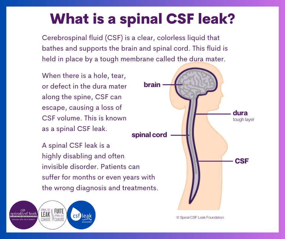 2023 Awareness week — SPINAL CSF LEAK CANADA