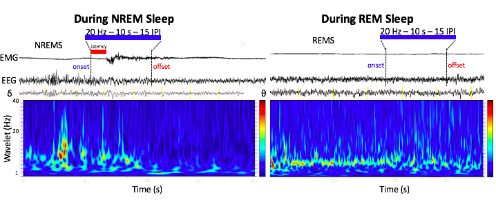 Optogenetic stimulation of lateral hypothalamic GABA neurons induces rapid arousal from NREM, but not REM sleep. These findings are consistent with those of Herrera et al., 2016 (image credit: JCB) (Note: These data are preliminary and are subject to change, any use without the author's consent is forbidden).