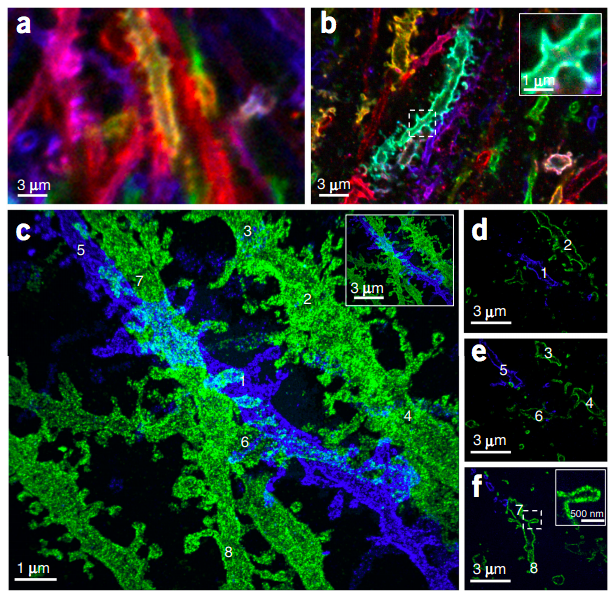 Iterative Expansion Microscopy allows for sample expansion up to 20x! Panel A shows dendritic spines without expansion, panel B shows the same at 4.5x expansion, and panel C shows dendritic spines at 20x expansion after the iterative process is complete (Credit: Chang et al., 2017; Nature Methods )