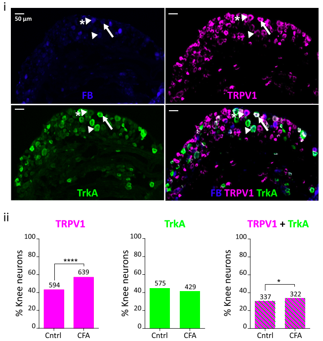 Neurons projecting to the inflamed knee (‘knee neurons’ labeled with FB) from the dorsal root ganglion expressed a much higher amount of the capsaicin receptor (TRPV1), without changes in the receptor for Nerve Growth Factor (a molecule associated with increased neural sensitivity; TrkA) (Credit: Chakrabarti et al., 2018; Neuropharmacology )
