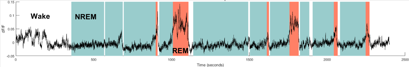 Example of a fiber photometry trace showing the activity of GABA neurons across sleep-wake states. As you can see, these neurons are mostly active during wakefulness and REM sleep compared to NREM sleep (wake = white background, NREM = blue, REM = red) (Credit: Jeremy C Borniger, PhD, Stanford University)