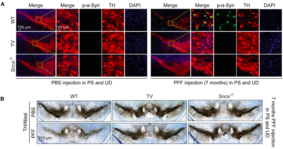 Trucal vagotomy (TV) or knockout of endogenous alpha-synuclein (Snca-/-) prevents the destruction of midbrian dopamine neurons characteristic of Parkinson’s disease! Note that alpha-synuclein aggregates (p-alpha-Syn; green color) were only observed in mice with intact vagal nerves and with normal copies of the Snca gene (Credit: Ko et al., 2019).