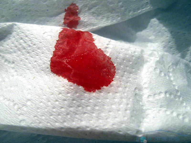 Blood in Stool.jpg