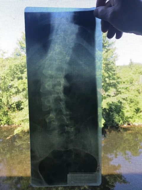 Spine 1.jpg