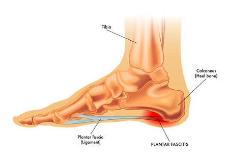 4 Ways to Relieve the Pain of a Stiff Big Toe - Solon Podiatrist