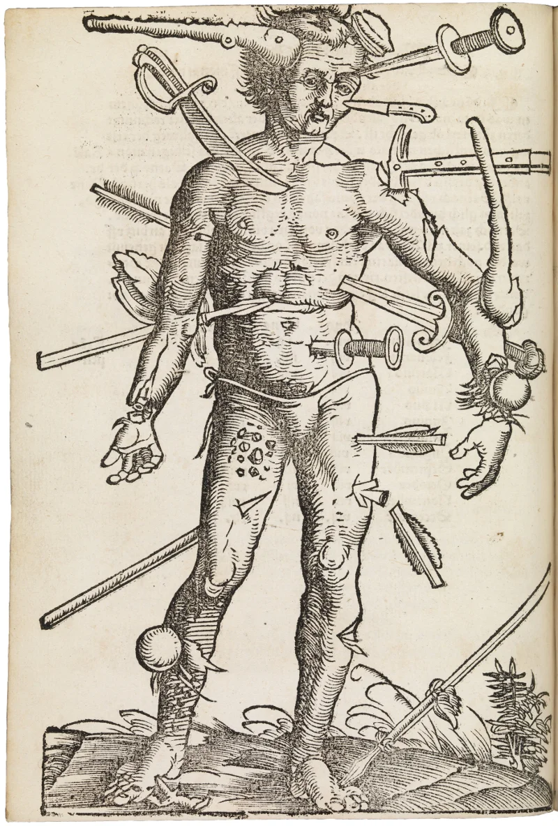 ‘Wound Man’ from Feldbuch der Wundarznei (Fieldbook of Surgery), written by Hans von Gersdorff in 1531