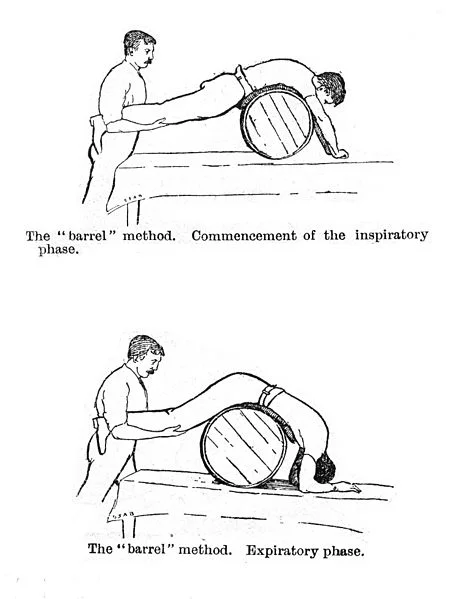 Artificial_respiration_by_rolling_a_man_prone_on_a_barrel._Wellcome_M0017194.jpg