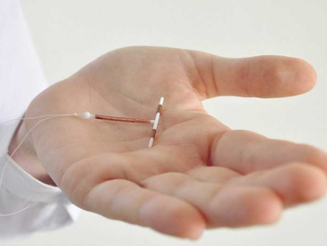 A YEAR AND COUNTING: MY IUD SAGA