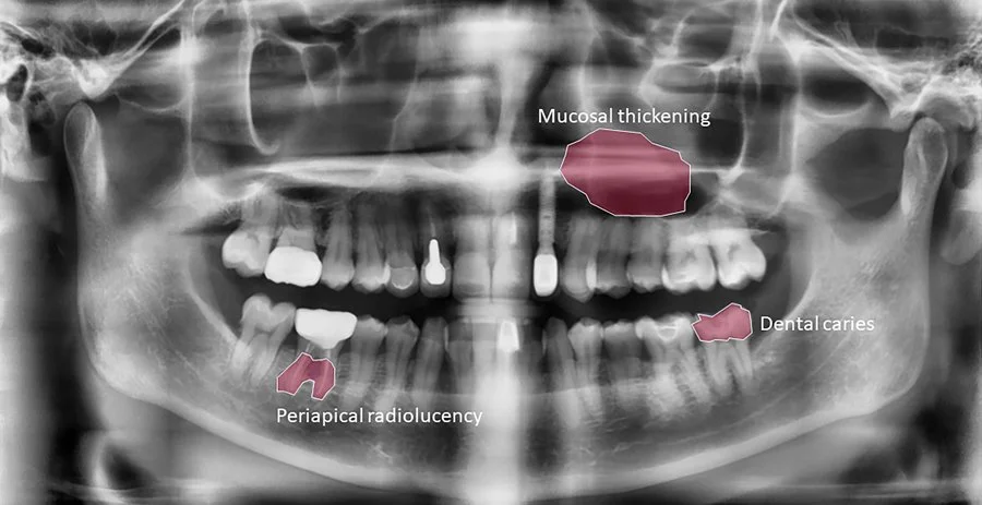 The Role of Machine Learning in Predictive Dentistry