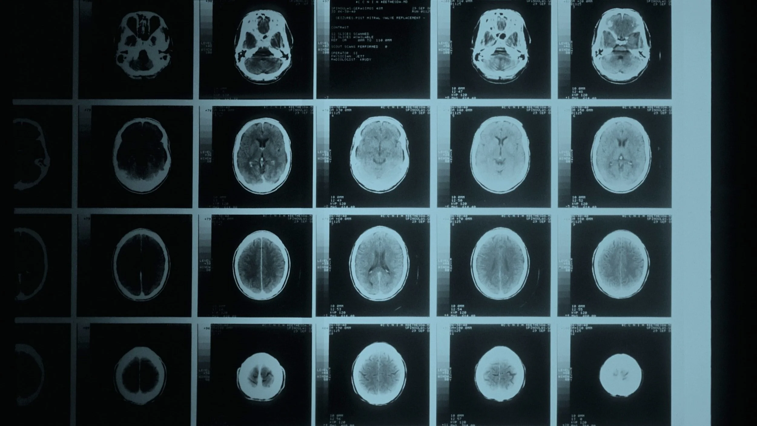 Exploring the Boundaries of Artificial Intelligence: Opportunities and Challenges