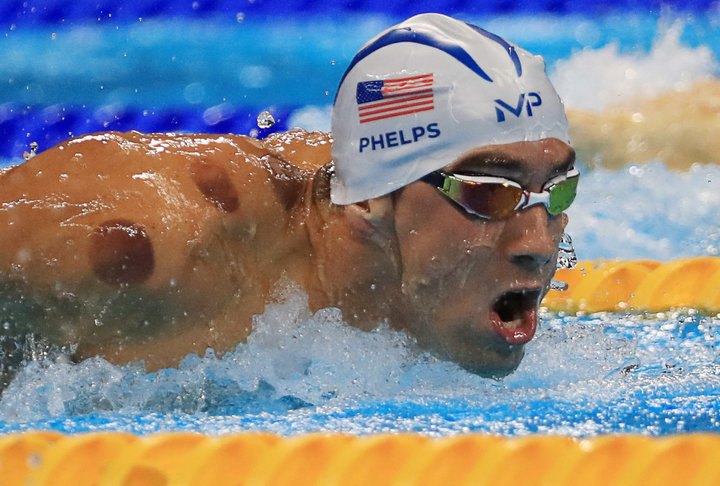 michael phelps cupping.jpeg