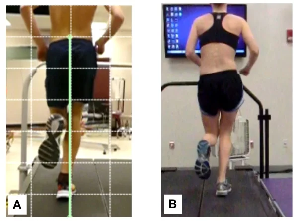Figure 2: Runner A demonstrates a narrow step width pattern and Runner B demonstrates a high hip adduction running pattern. Both increase strain in the ITB