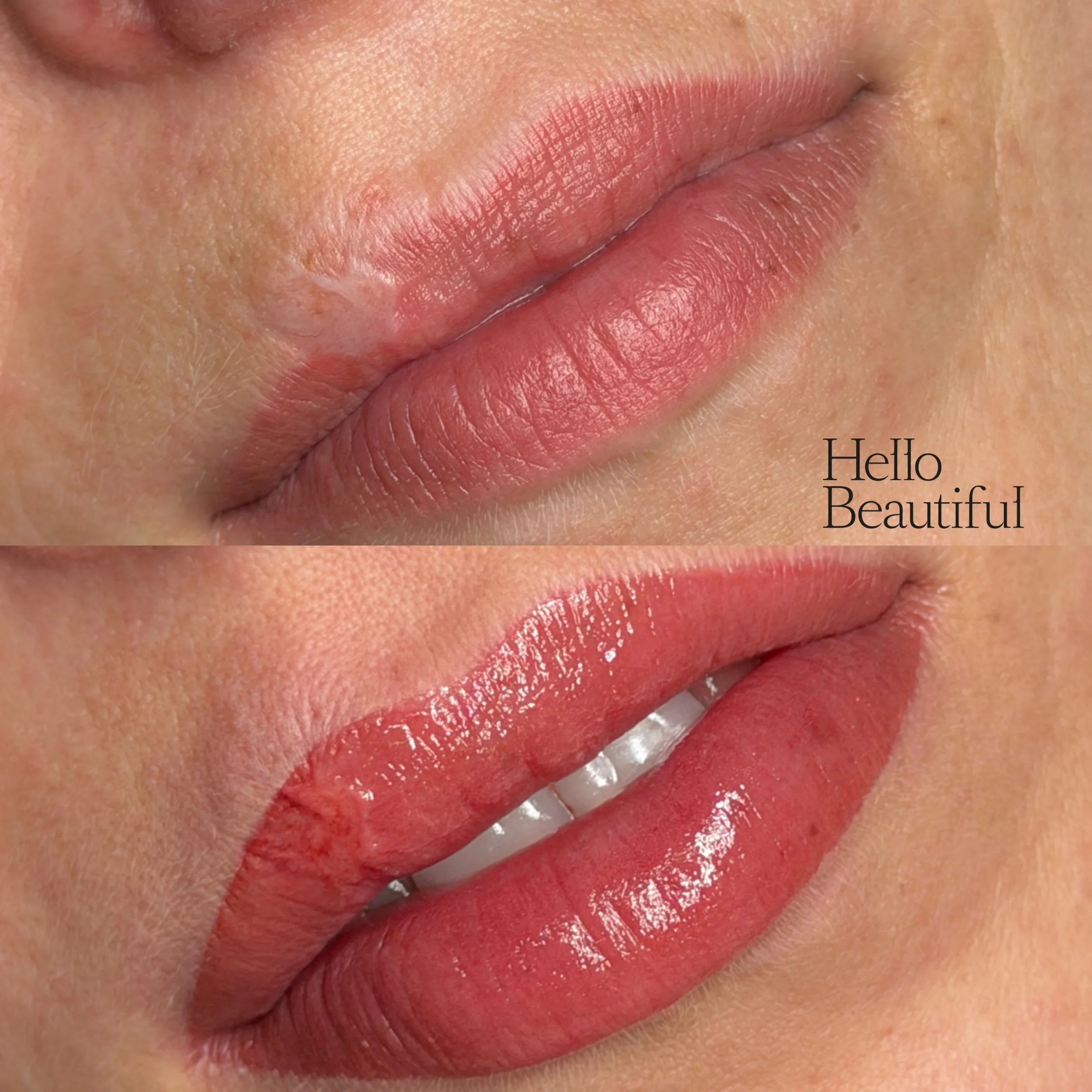 Frische Powder Lips/Narbenkorrektur