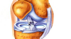 torn-acl-treatment-nyc.jpeg