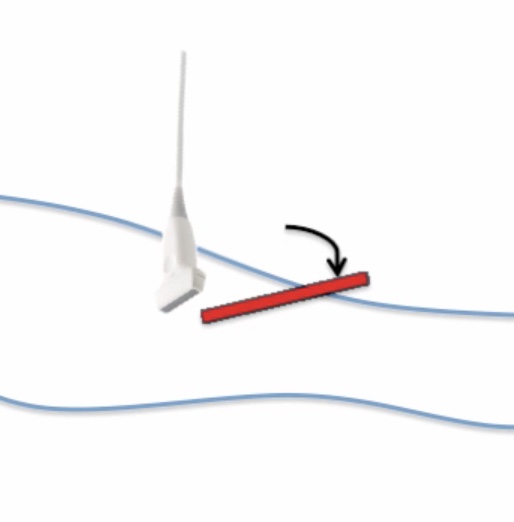 drop-angle.jpg