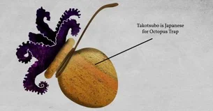 takotsubo.jpg