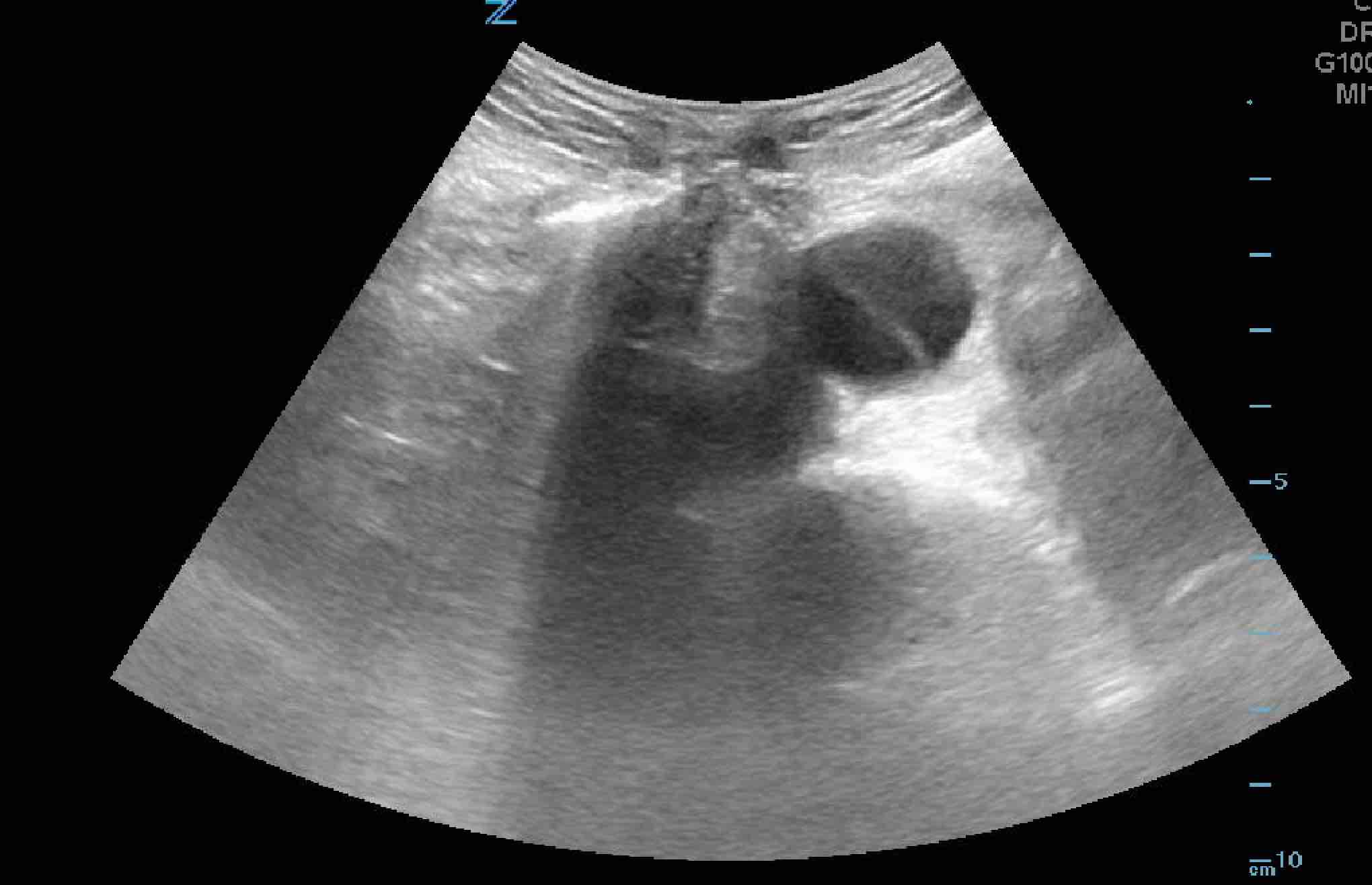 abdominal.jpg