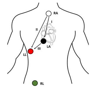 1. You can do this on the monitor, you don’t need a 12lead 2. Arrange the leads as seen here. ( The green one can go anywhere, it’s just an electrical ground ) 3. Check for atrial activity