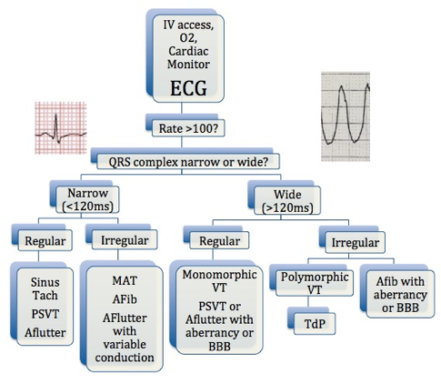 Tachydysrhythmia Algorithm