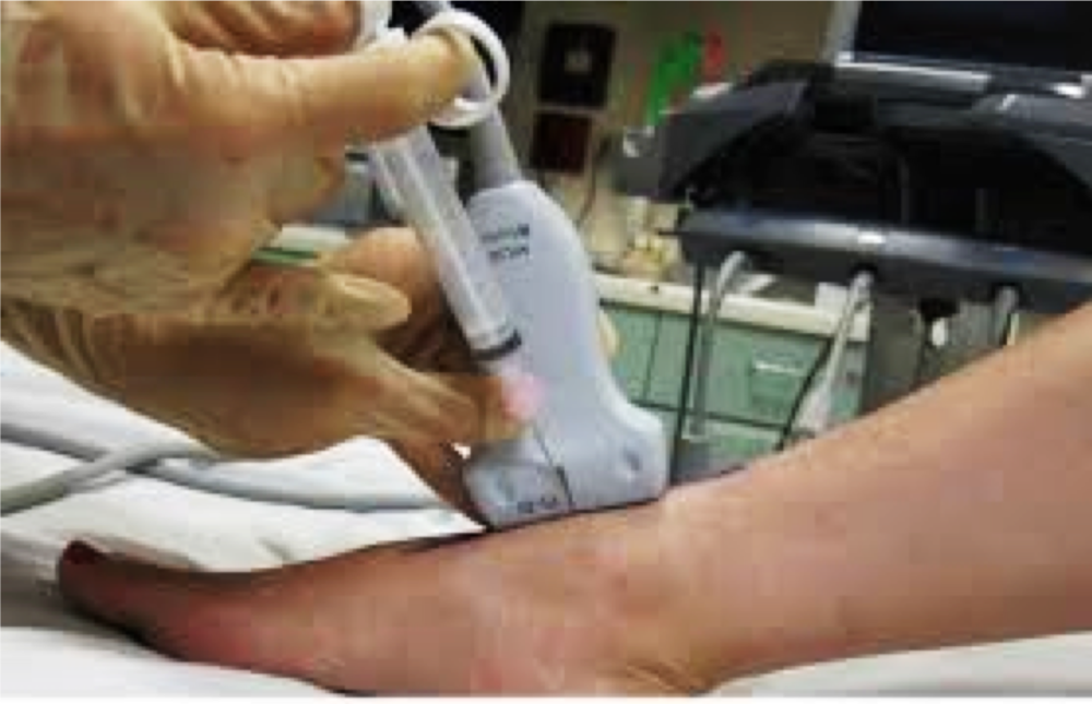 AnkleTap.png