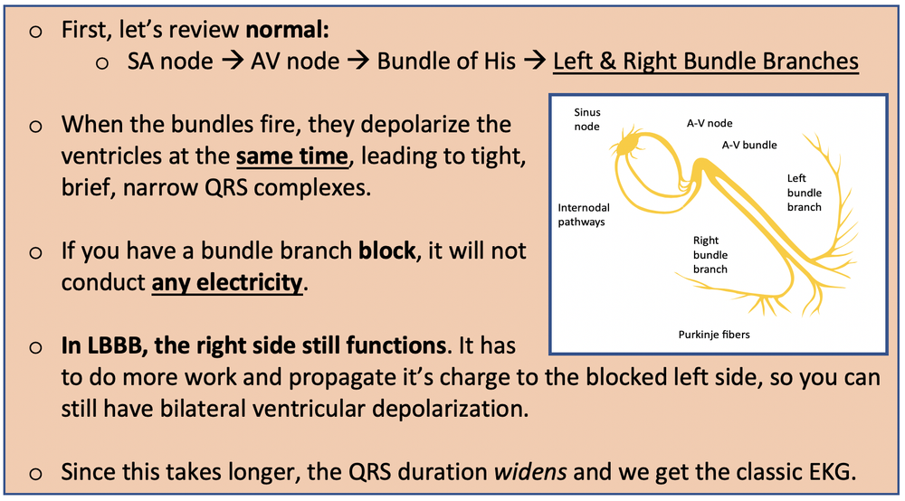 Left Bundle Branch Blocks + AMI — Maimonides Emergency Medicine Residency
