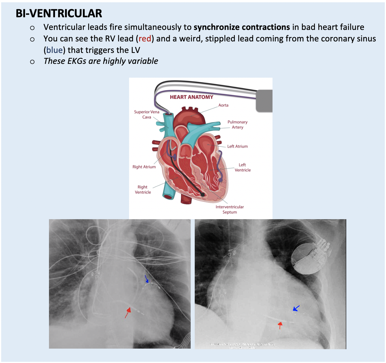 Pacemakers for the ER Physician — Maimonides Emergency Medicine Residency