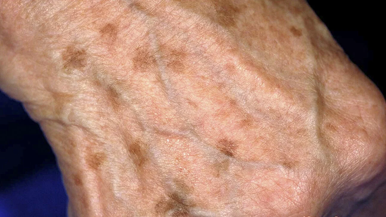 Basics Of Dermatology 1 Maimonides Emergency Medicine Residency Basics Of Dermatology 1 Maimonides Emergency Medicine Residency