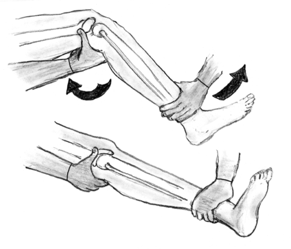 Knee Dislocation — Maimonides Emergency Medicine Residency