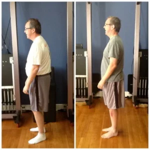 SteveH_BeforeAfter_LT_SIDE-300x300.jpg