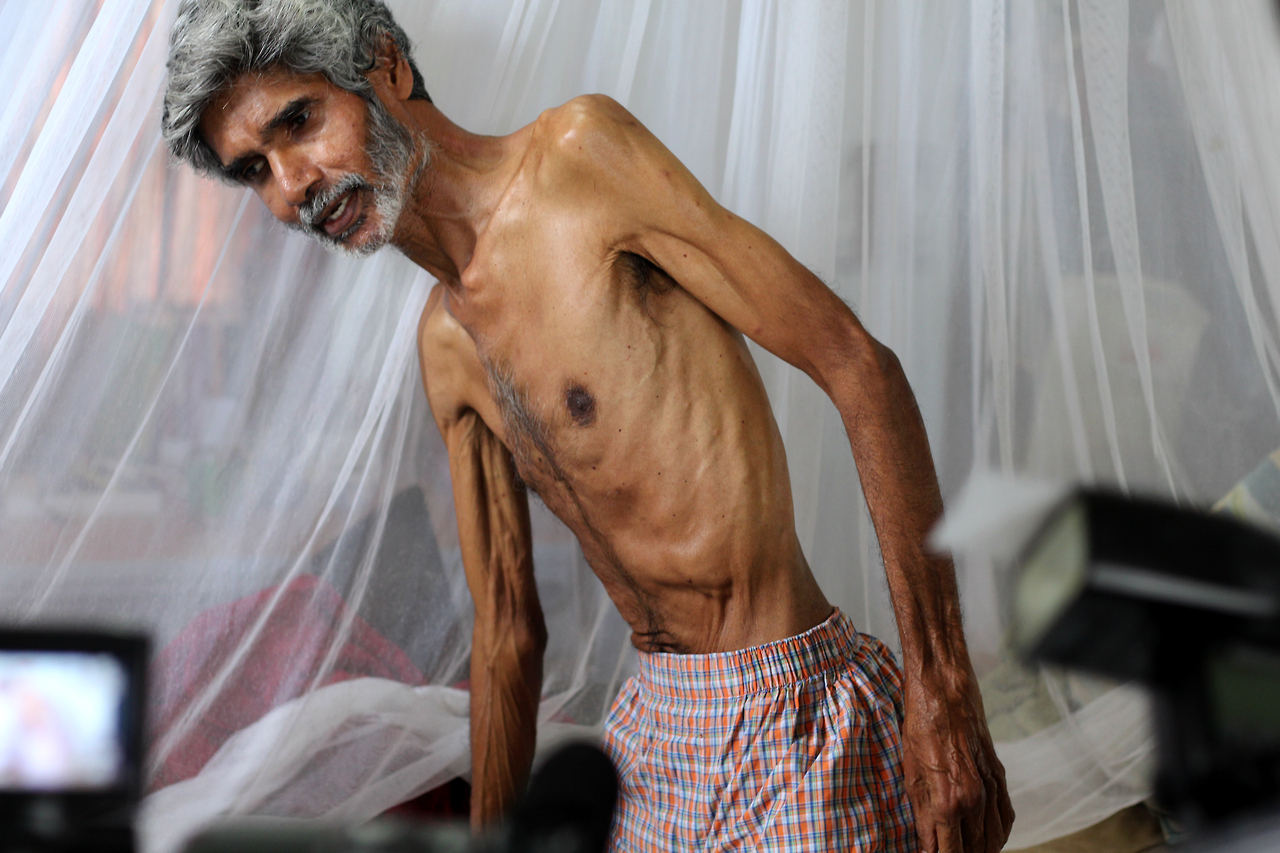 Environmental activist, Dr Kublalsingh, continues his hunger strike for the Highway Reroute Movement, hitting Day 83 today. Although he is in critical condition, he claims that he will not stop even if it means mortality. | The Guardian newspaper, Trinidad and Tobago