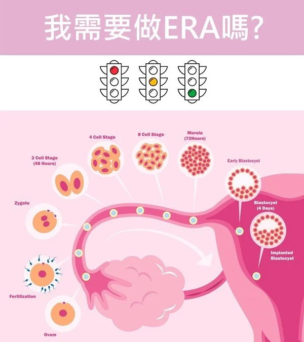 我需要做ERA(子宮內膜基因晶片)嗎？