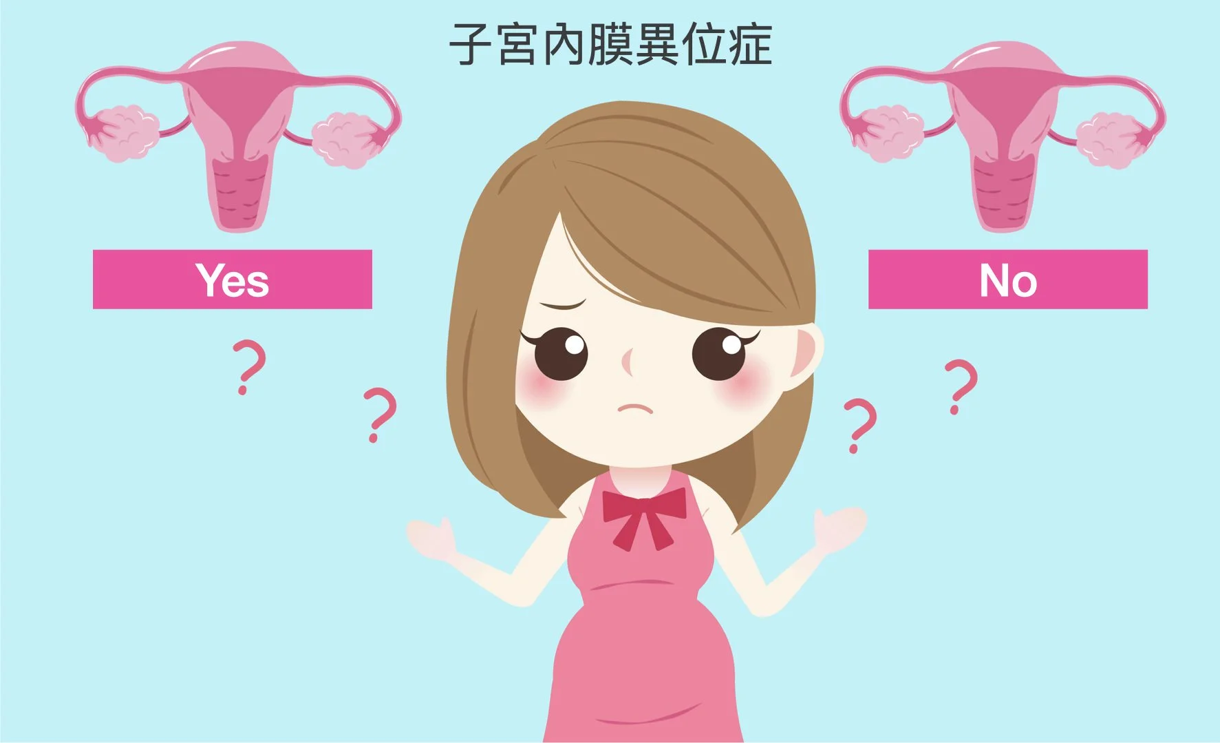有些醫師說我有子宮內膜異位症，有些說沒有？