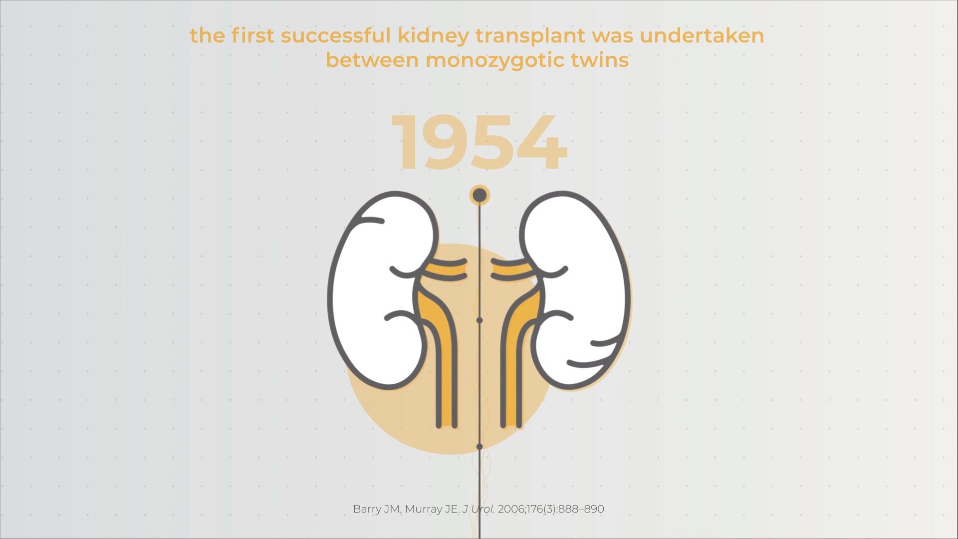 Novartis | Kidney Transplantation Timeline