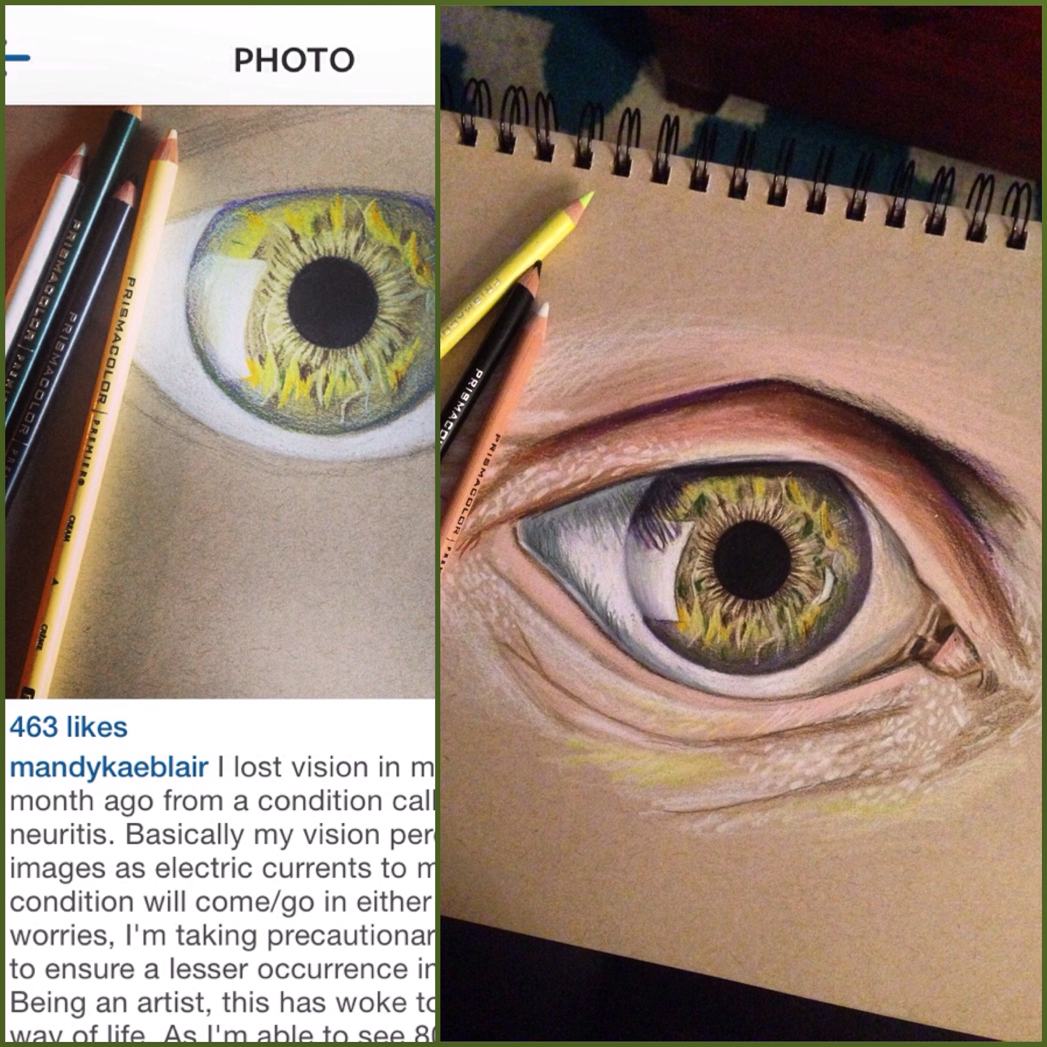 *Former post from after my vision started to return.*