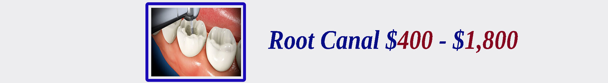 root-canal.jpg