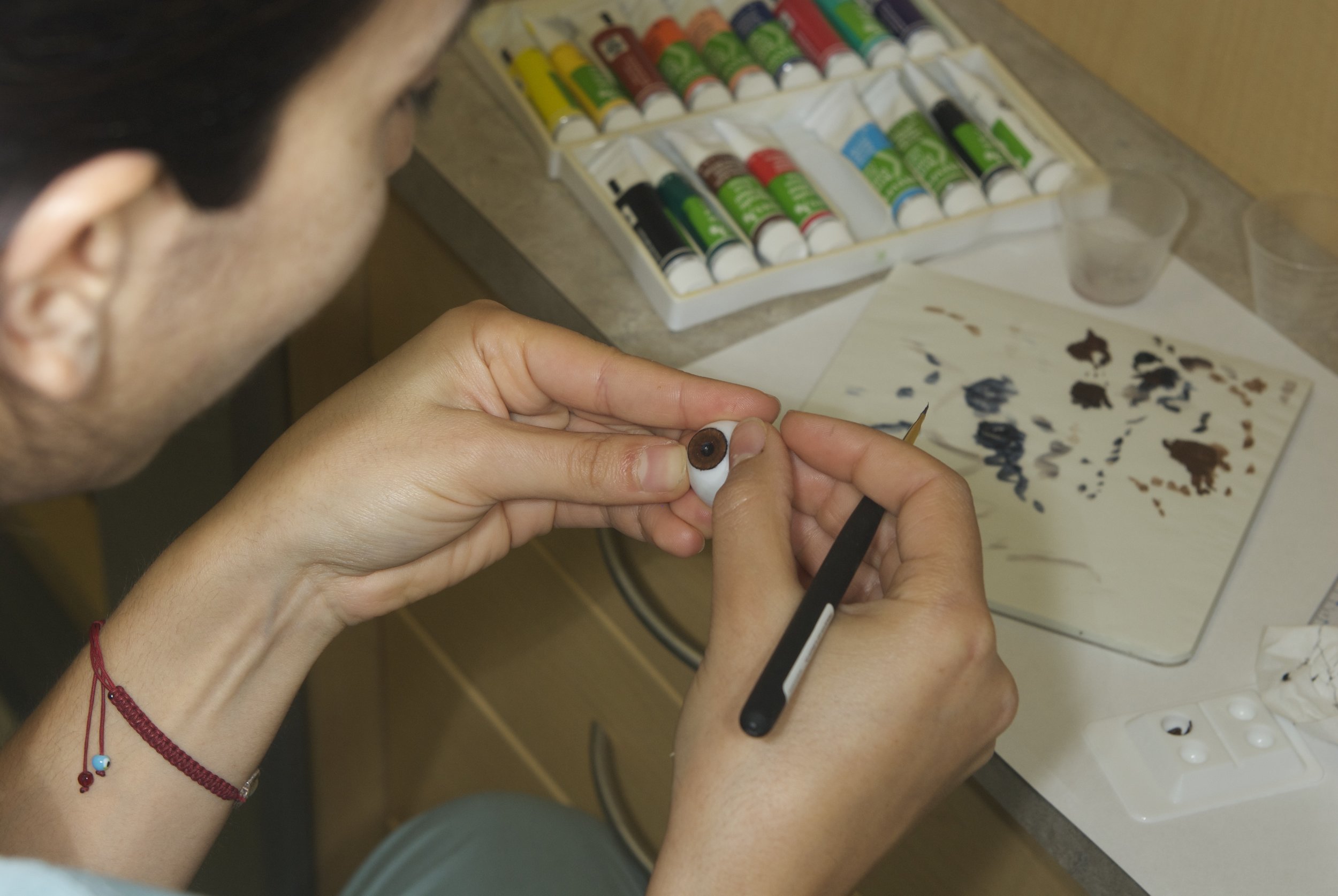 Teaching Maxillofacial fellow how to custom make an ocular globe for an "eye" prosthesis. 