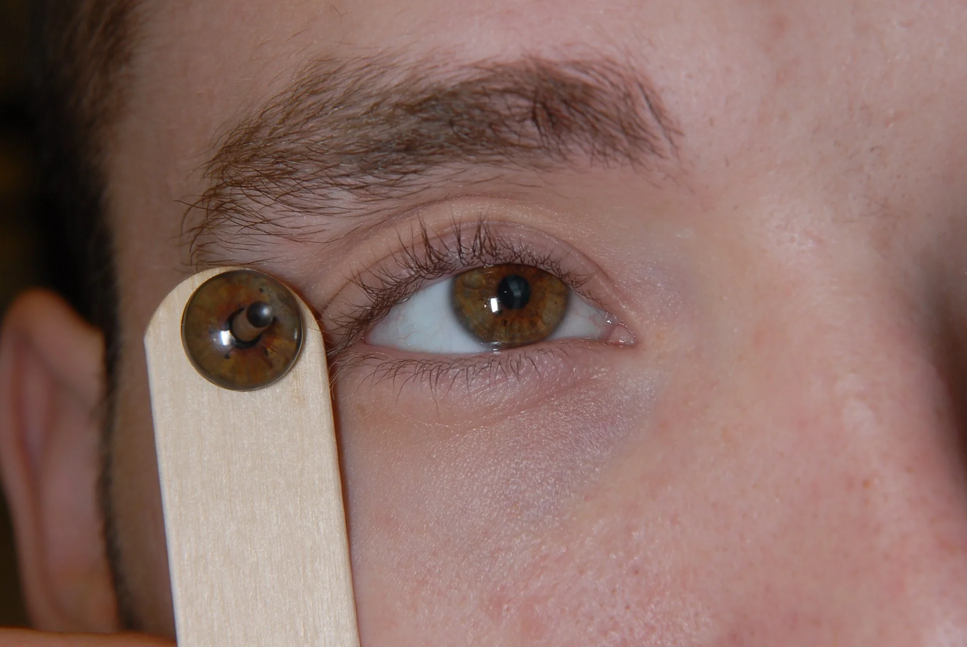 Maxillofacial prosthetics — Prosthodontics, Special Patient Care