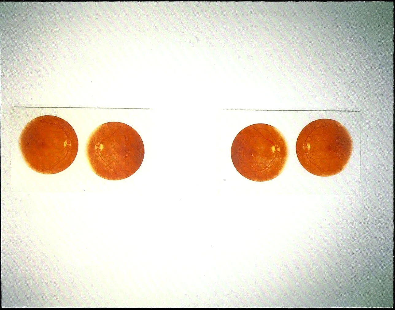 MANGLANO - OVALLE Inigo 