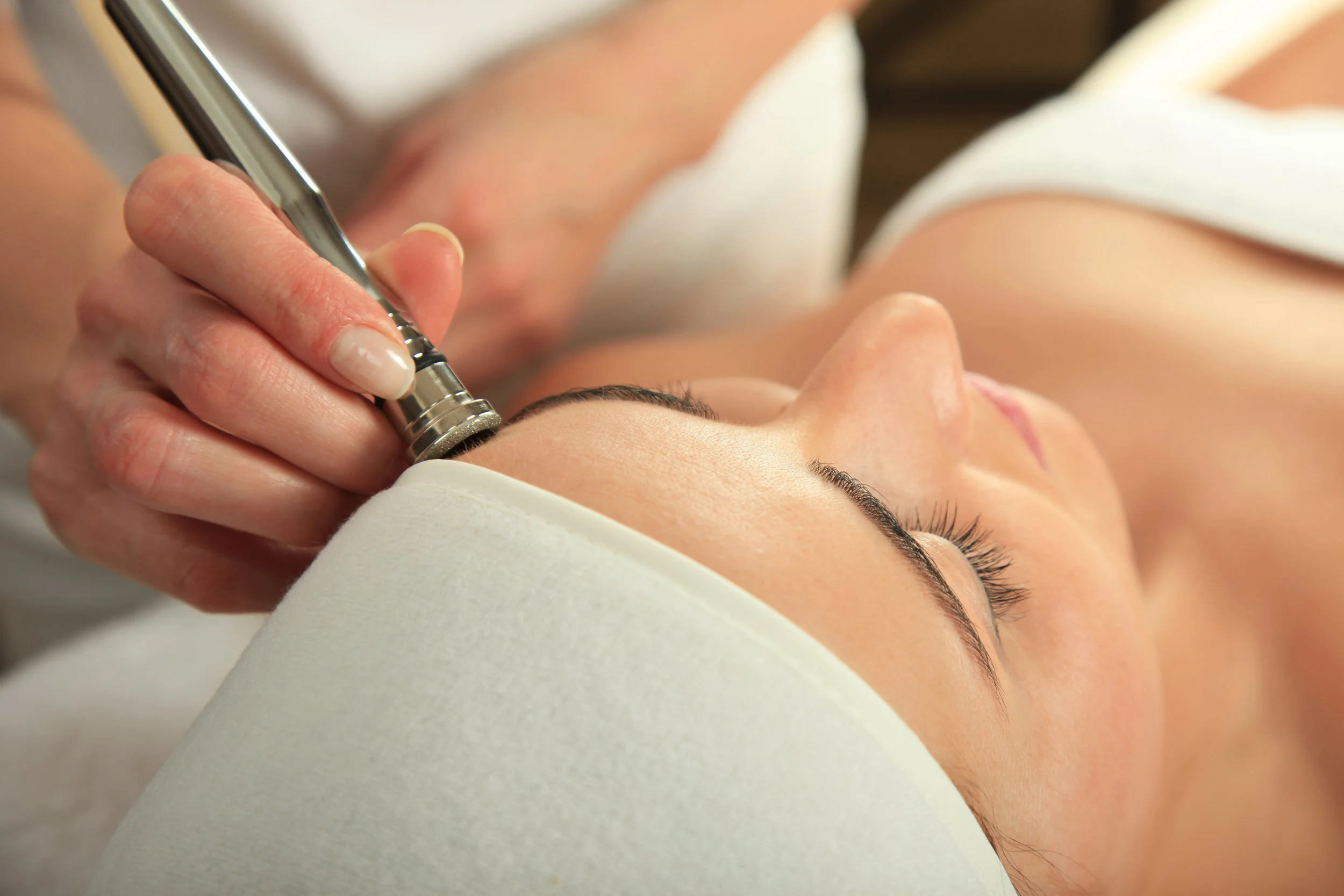 What is Microdermabrasion?